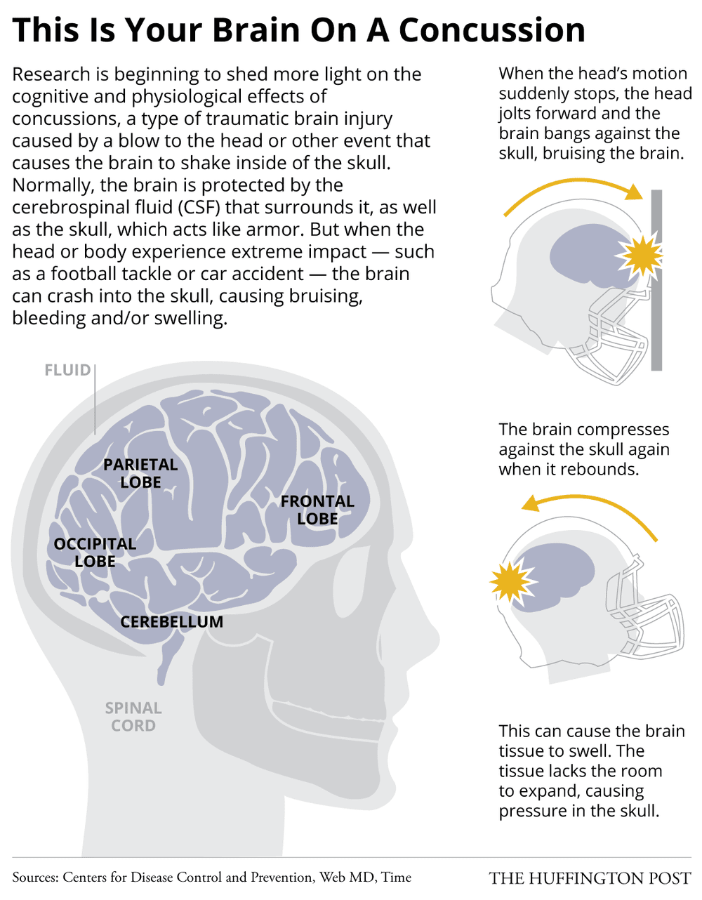 Concussions.png